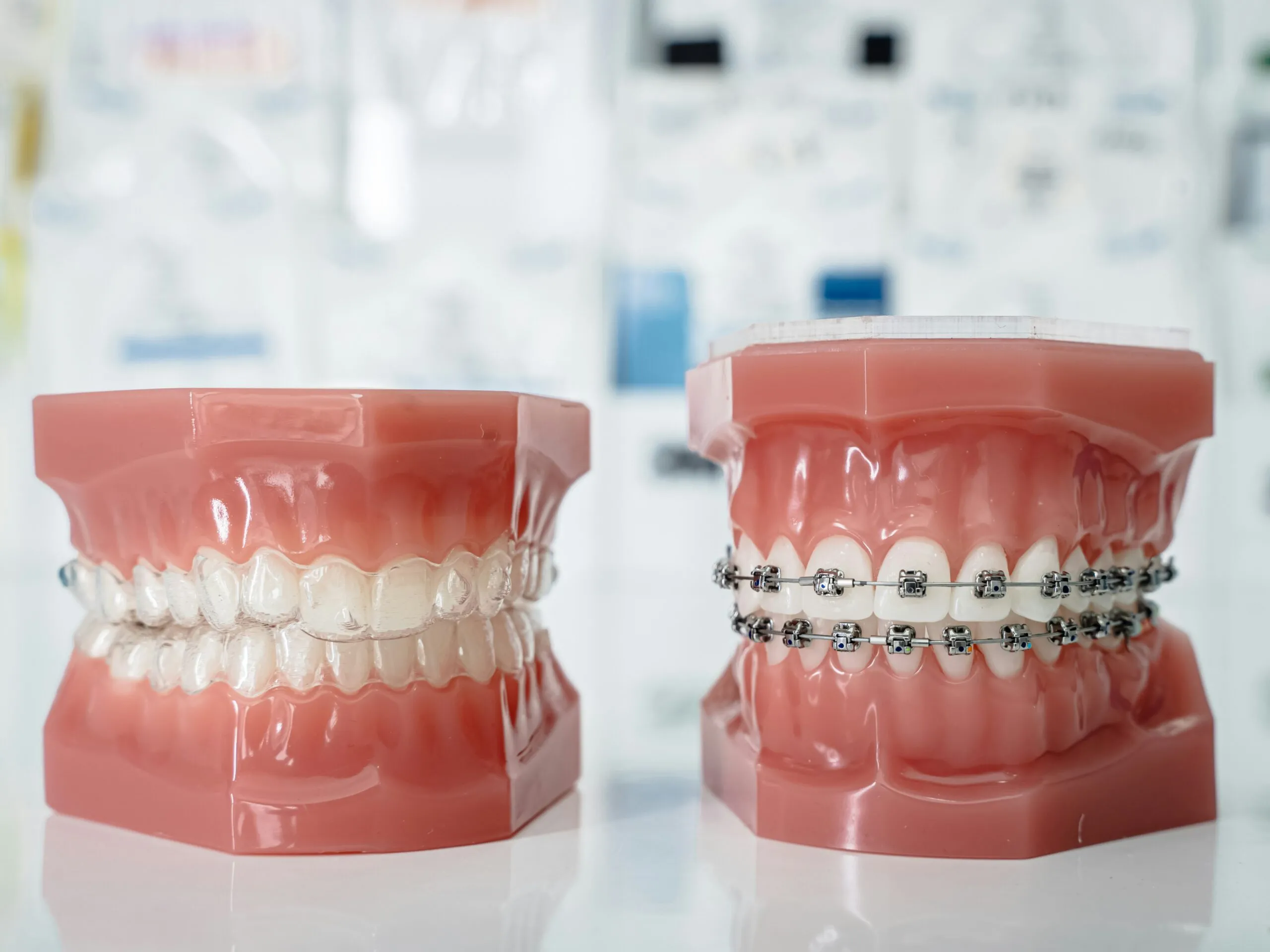 Invisalign; traditional braces